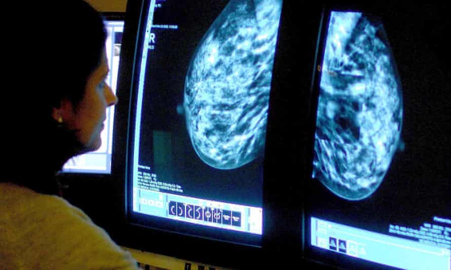 Targets to give patients tests such as for breast cancer are slipping, experts warn.