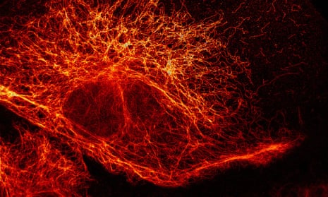 A network of filaments in a mammalian cell revealed by fluorescence microscopy.