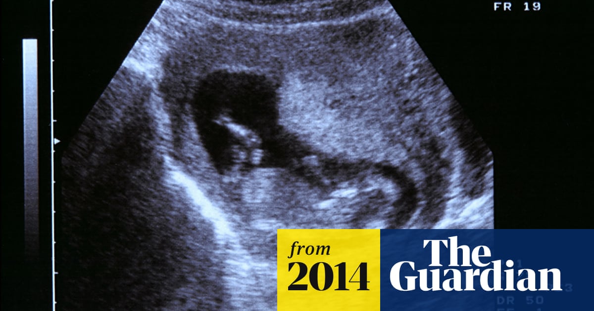 Let S Talk About Miscarriage Pregnancy The Guardian Let S Talk About Miscarriage Pregnancy The Guardian