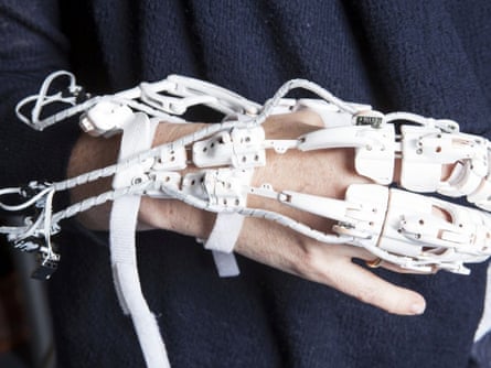 robotic exoskeleton hand