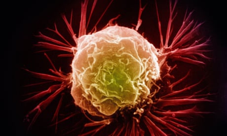 Royal Society books shortlist: Cancer Chronicles by George Johnson – review