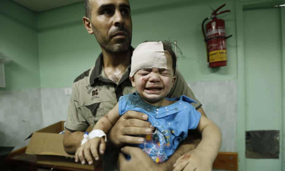 A Palestinian child, wounded in an Israeli strike on a compound housing in Jabalia. The 50-day conflict killed more than 2,100 Palestinians and 72 Israelis