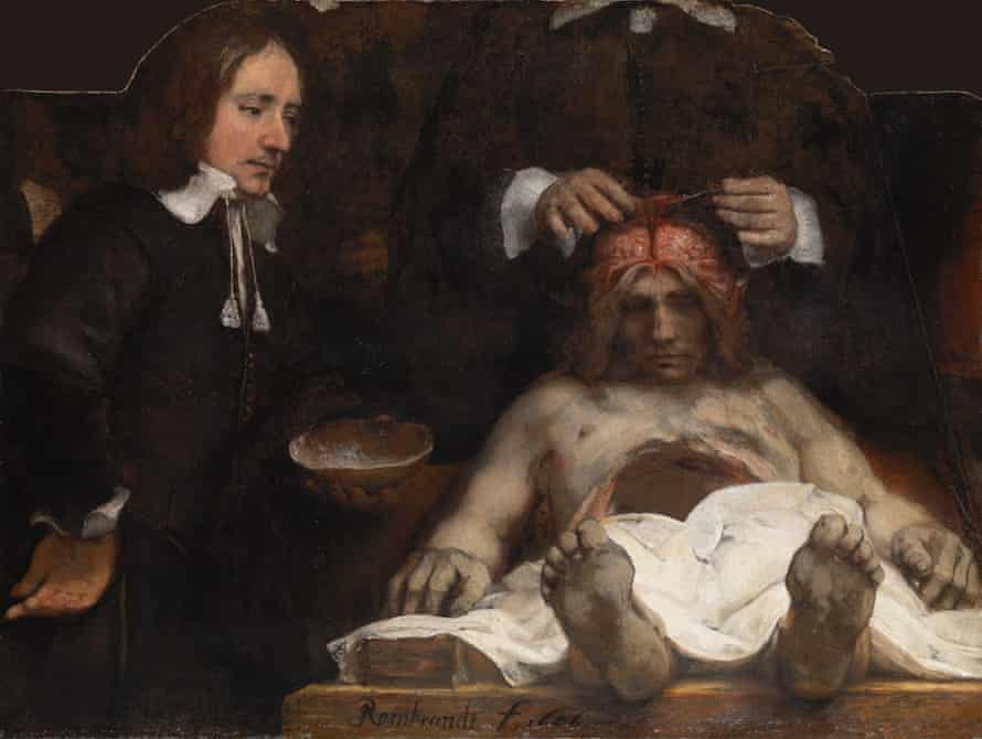 Rembrandt The Anatomy Lesson of Dr Joan Deyman, 1656