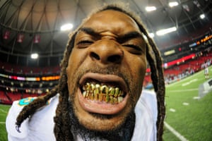 8 August: Louis Delmas of the Miami Dolphins bears his teeth after a pre-season game against the Atlanta Falcons at the Georgia Dome in Georgia
