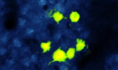 High-speed calcium imaging shows simultaneous activation of six neurons arranged in the shape of a smiley face.