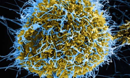 Colourised scanning electron micrograph of filamentous Ebola virus particles.