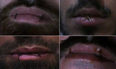 Four Manus Island asylum seekers have sewn their lips