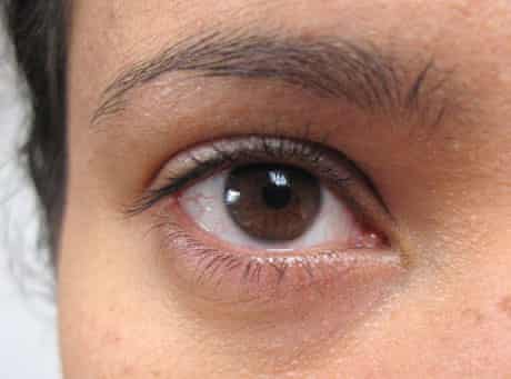 M's eye before the eye cream trial