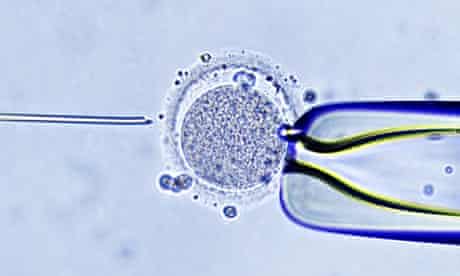 IVF sperm egg