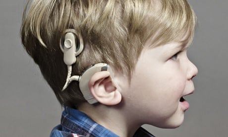 Hearing aids and implants - NHS
