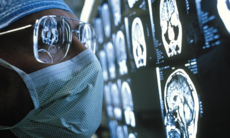 Surgeon examining MRI (Magnetic Resonance Imaging) scans of brain