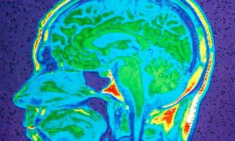 World’s first computational psychiatry centre opens in London