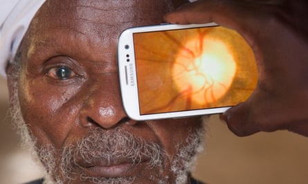 Eye scanner … The Peek app turns any camera phone into a portable eye examination kit.