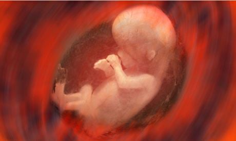 Human foetus