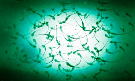 Microscopic image of sperm