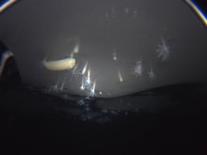 Andrill Anemone, living anchored in the ice at the underside of the Ross Ice Shelf, Antarctica.