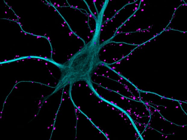 Excitatory synapses on a hippocampal neuron  Image: Kieran Boyle/ University of Glasgow