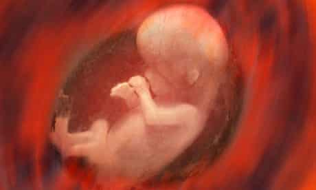 Unborn children could undergo surgery