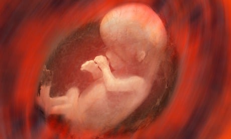 Unborn children could undergo surgery