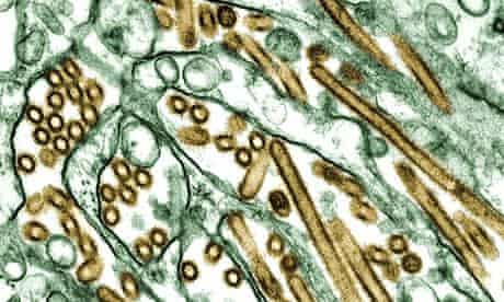 Avian virus H5N1 in electron micrograph