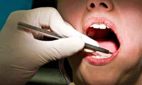 No More Fillings As Dentists Reveal New Tooth Decay Treatment Society The Guardian
