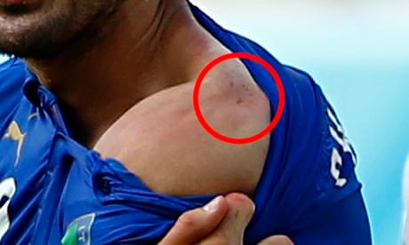 https://i.guim.co.uk/img/static/sys-images/Guardian/Pix/pictures/2014/6/24/1403638895587/Giorgio-Chiellini-008.jpg?crop=none&dpr=1&s=none&width=465