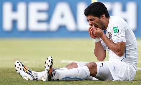 Luis Suárez holds his teeth after appearing to bite Italy's Giorgio Chiellini.
