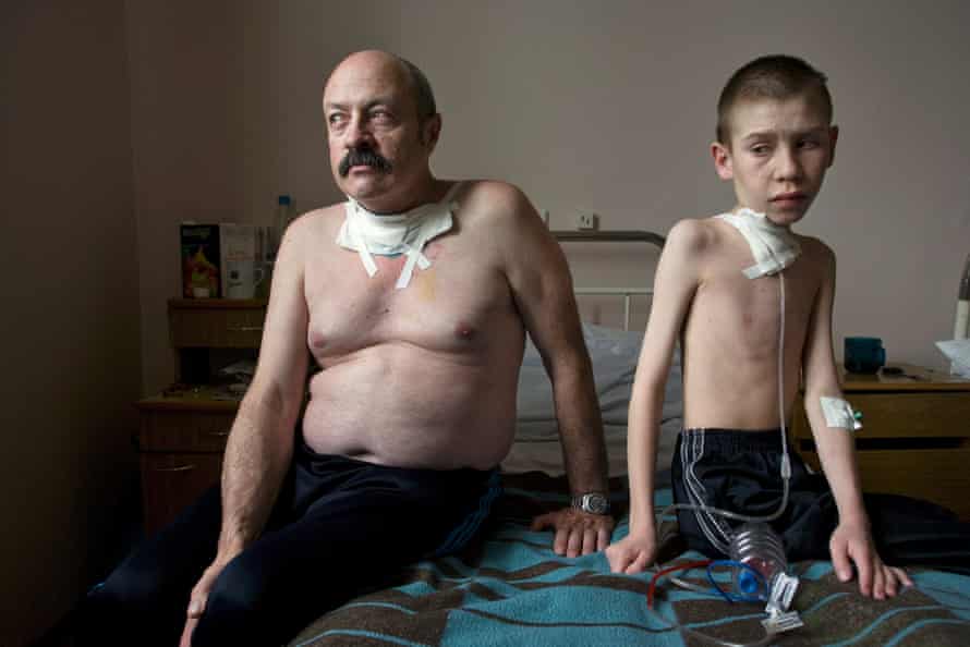The Long Shadow of Chernobyl :  At the Thyroid Center in Minsk, surgery is performed on a daily basis. Amongst the patients in room #4 was Dima Bogdanovich, 13, who had just undergone his first surgery for thyroid cancer, and liquidator, Oleg Shapiro, 54.