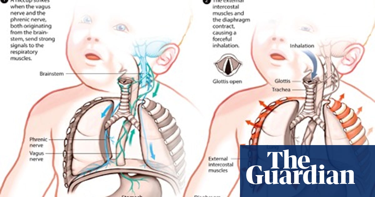 Has science solved the mystery of the hiccup? Don't hold your breath | Human biology | The Guardian Has science solved the mystery of the hiccup? Don't hold your breath | Human biology | The Guardian
