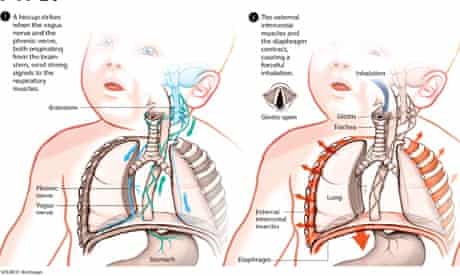Has Science Solved The Mystery Of The Hiccup Don T Hold Your Breath Human Biology The Guardian Has Science Solved The Mystery Of The Hiccup Don T Hold Your Breath Human Biology The Guardian