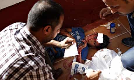 Employees of Gaza City's al-Deira hotel take care of a wounded boy -  gaza port shelling