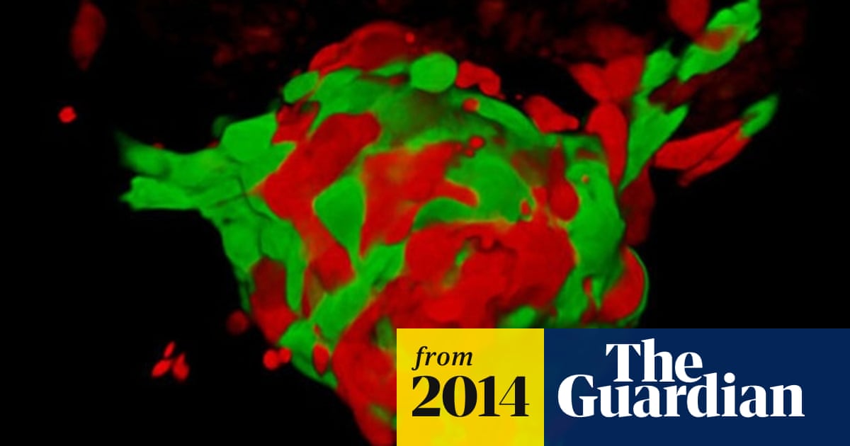 Piggybacking cells hold clue to cancer growth – and treatment for melanoma