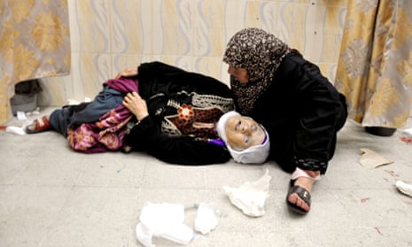 A Palestinian woman lies at a hospital in the northern Gaza  Israel-Gaza conflict, Gaza Strip, Palestinian Territories - 24 Jul 2014