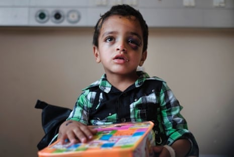 Marwan Hassanein, 4, receives a present for the Eid al-Fitr holiday, at the Shifa hospital in Gaza City, where he is hospitalized, Monday, July 28, 2014. Marwan was injured in head and eyes by shrapnel while fleeing with his family on July 20 during Israeli shelling in the Shijaiyah neighborhood.