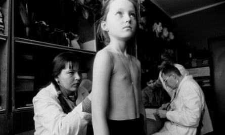 A school child has a medical examination in the Gomel region of Belarus, which was contaminated by the Chernobyl nuclear accident.