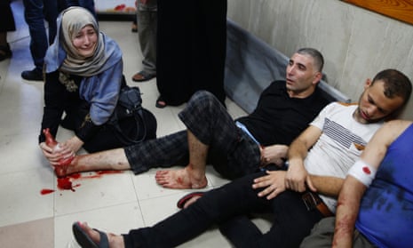 A Palestinian woman cries as she tries to stop the bleeding of her brother's foot, whom medics said was wounded by Israeli shelling in Shejaia, at a hospital in Gaza City July 30, 2014.