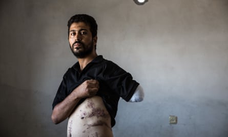 Nabil Siyyam lost his wife and four children, along with his left arm. 'I saw my daughter cut into two.'