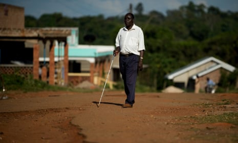 Trachoma is leading cause of blindness in sub-Saharan Africa 