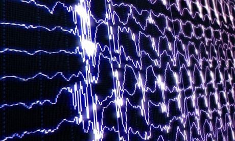 brain waves scanner screen