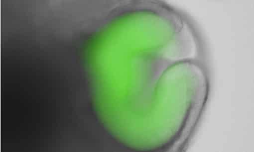 Mouse ES cells organise themselves into embryonic eyes when grown in 3D suspension. Image: Yoshiki Sasai/ Mototsugu Eiraku/ RIKEN Center for Developmental Biology.