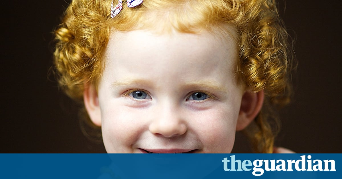 Providencia recommends best of Scottish redhead girl girl Scottish redhead