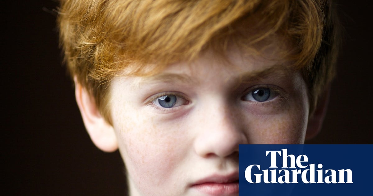 Gingers Scotlands Redheads In Pictures Fashion The Guardian 