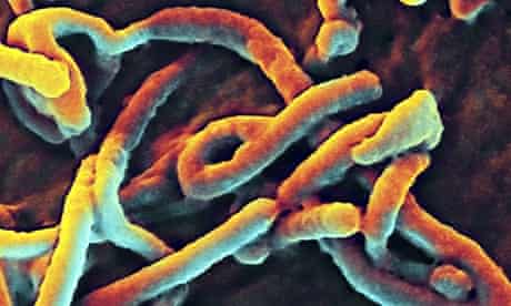Senegal confirms Ebola virus