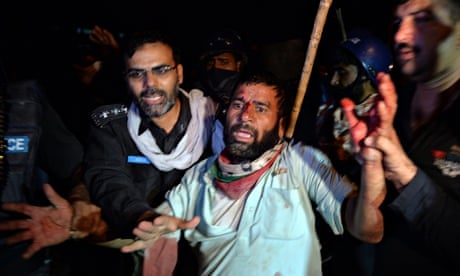 Protests Islamabad arrest injured man