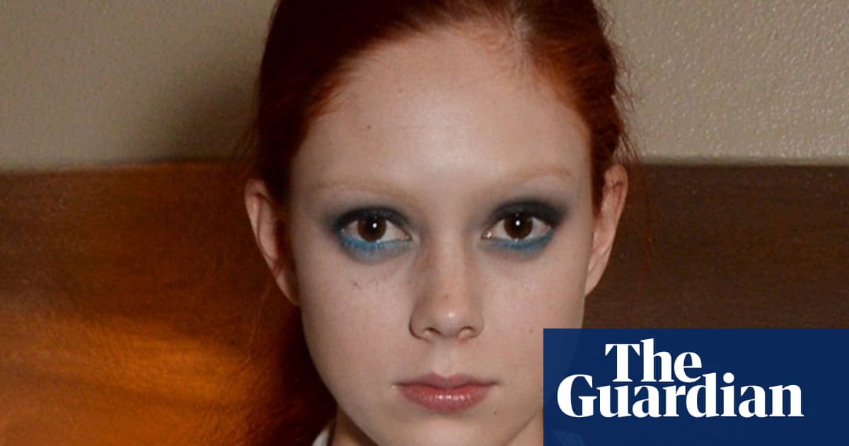Freckles The New Beauty Spot Beauty The Guardian 