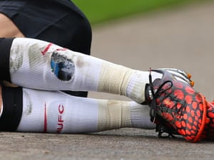 Angel Di Maria's socks showed the signs of a bad challenge. Not only that, they revealed that he keeps a photo of his wife and daughter stuffed inside them during matches.