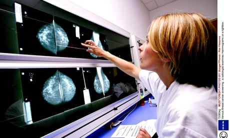 Doctor and mammogram