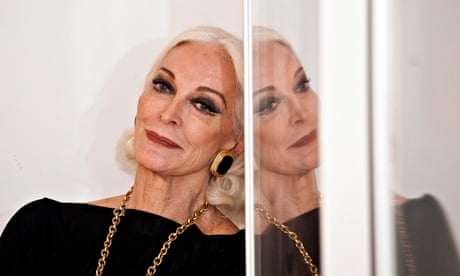 carmen dellorefice plastic surgery before and after