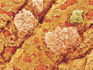 liver