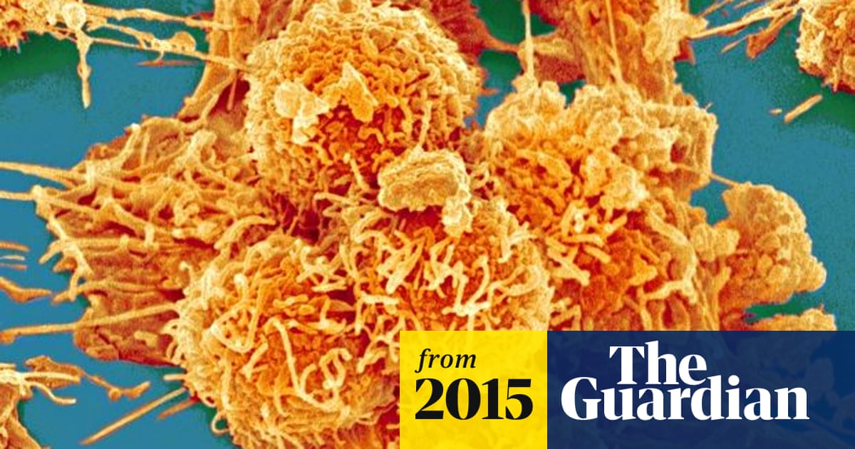 Two Thirds Of Adult Cancers Largely Down To Bad Luck Rather Than Genes Cancer The Guardian